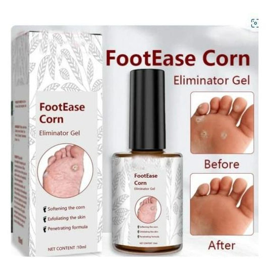 Feet Corn Removal Serum 30ml ( Pack Of 1 ) - OwnzoKart