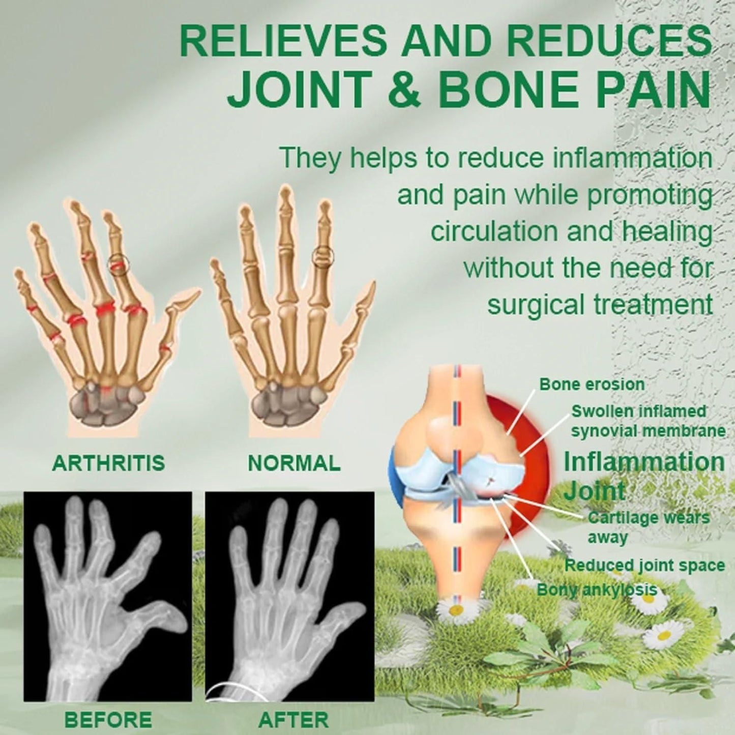 Bee Venom Joint & Bone Therapy Cream 100g - Pack of 2 - OwnzoKart