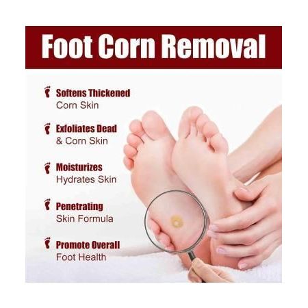 Feet Corn Removal Serum 30ml ( Pack Of 1 ) - OwnzoKart
