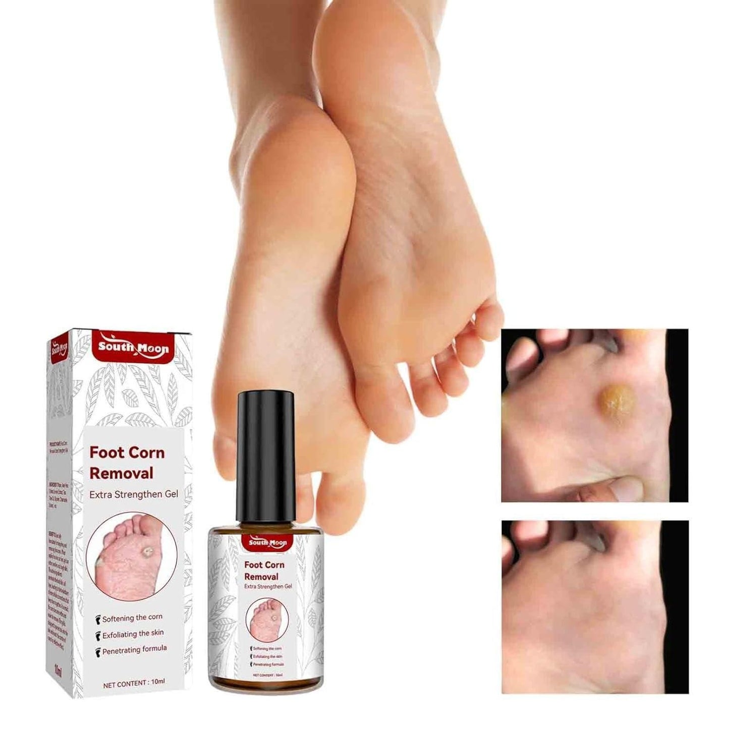 Feet Corn Removal Serum 30ml ( Pack Of 1 ) - OwnzoKart